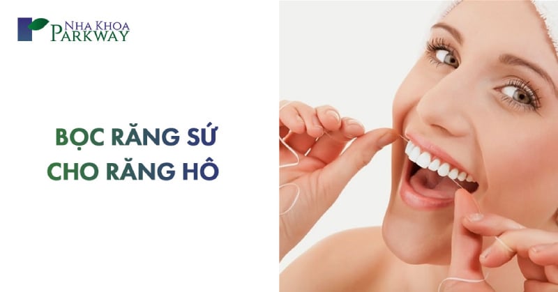 bọc răng sứ cho răng hô vẩu giá bao nhiêu tiền