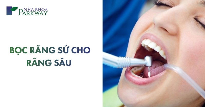 bọc răng sứ cho răng sâu bao nhiêu tiền