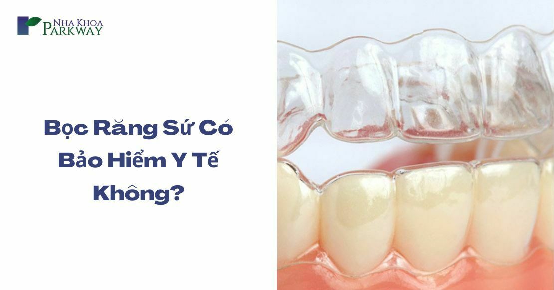 Bọc răng sứ có được bảo hiểm không