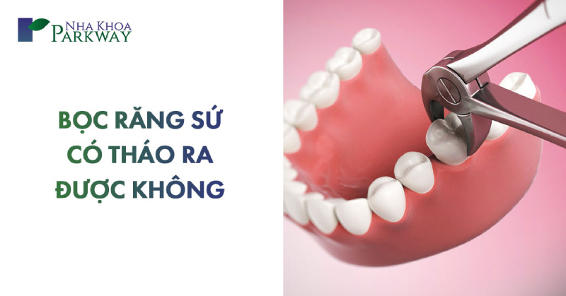 bọc răng sứ có tháo ra được không