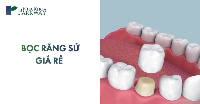 bọc răng sứ giá rẻ nhất là bao nhiêu tại tphcm