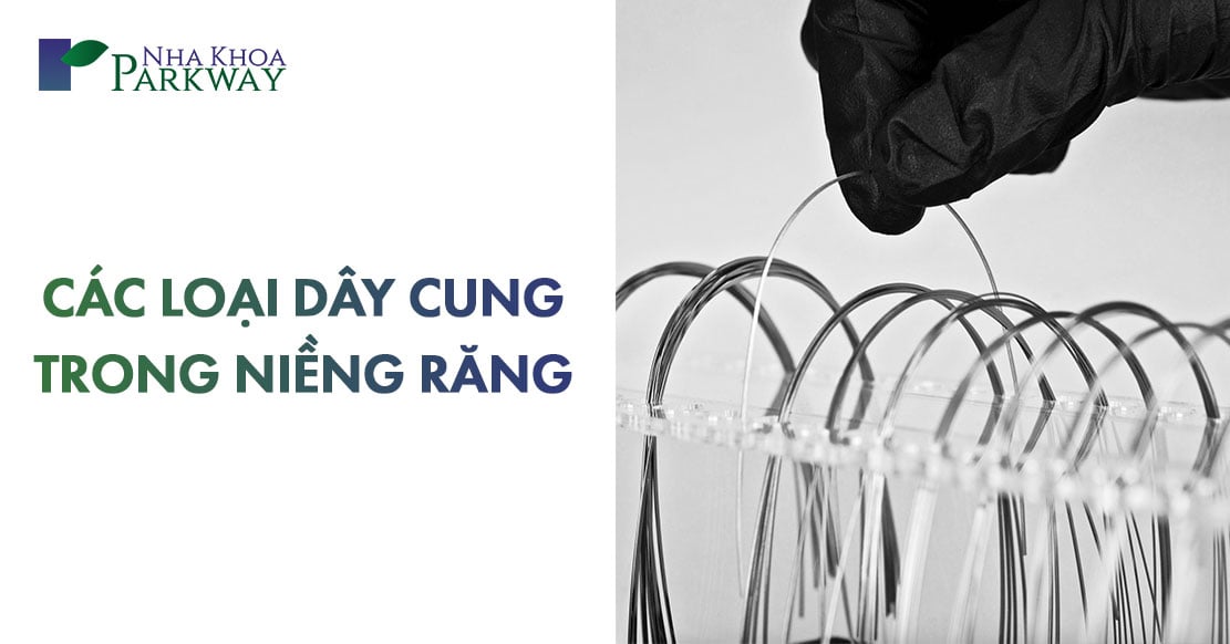 các loại dây cung trong niềng răng