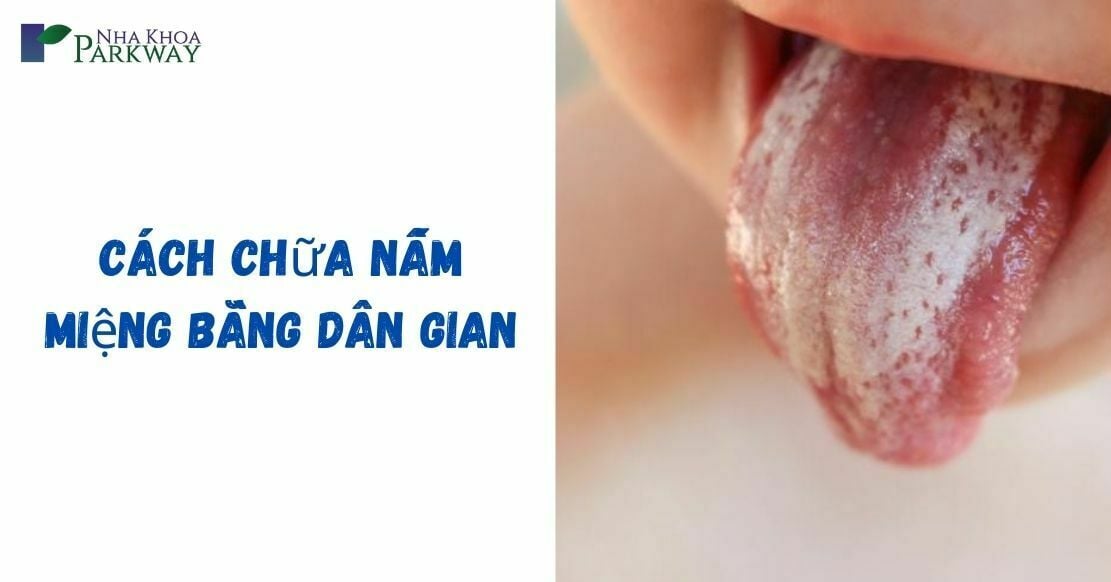 cách chữa nấm miệng bằng dân gian