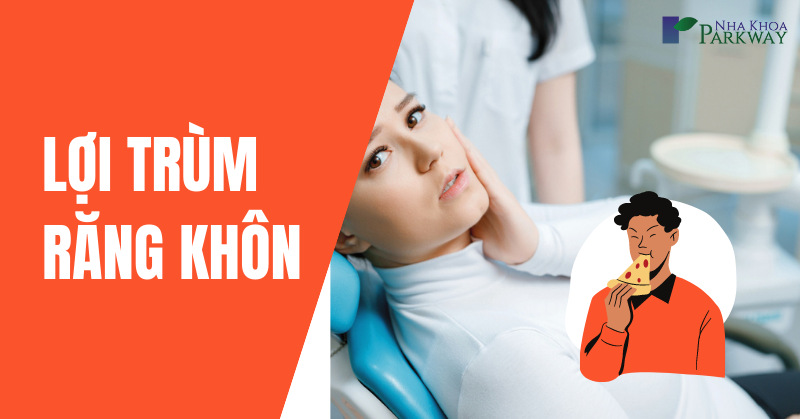 cách chữa răng khôn bị lợi trùm