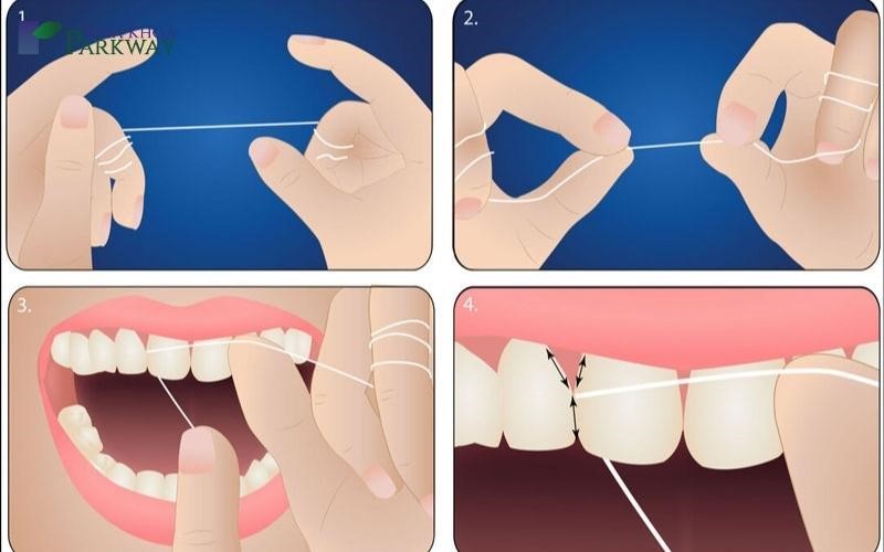 cách dùng chỉ nha khoa đúng cách