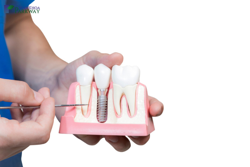 cắm implant có gây đau nhức không