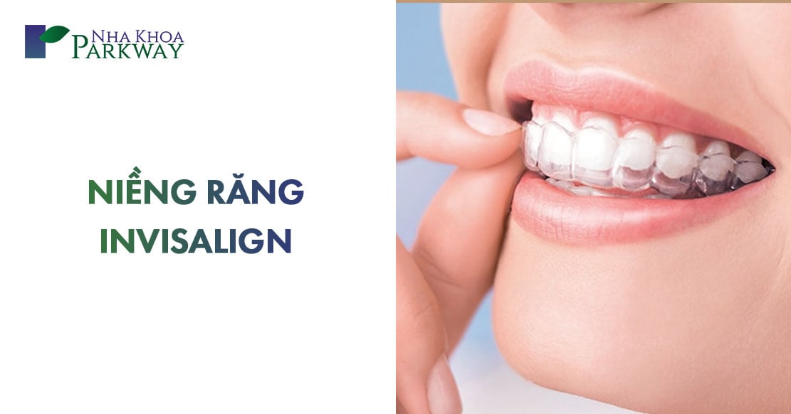 chi phí niềng răng invisalign giá bao nhiêu tiền