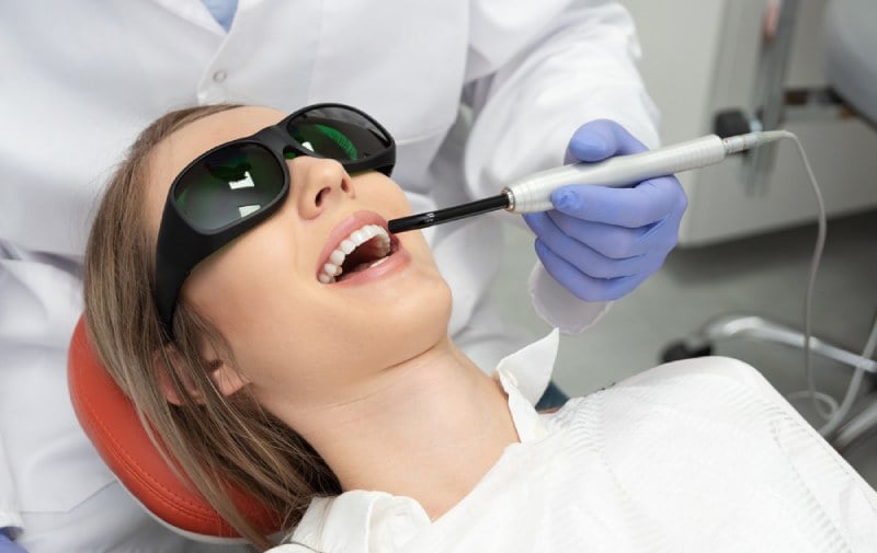 chi phí tẩy trắng răng bằng tia laser