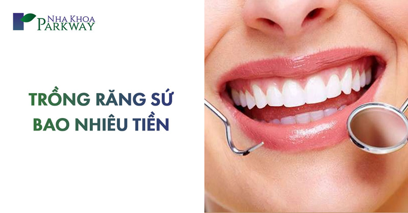 chi phí trồng răng sứ giá bao nhiêu 1 chiếc