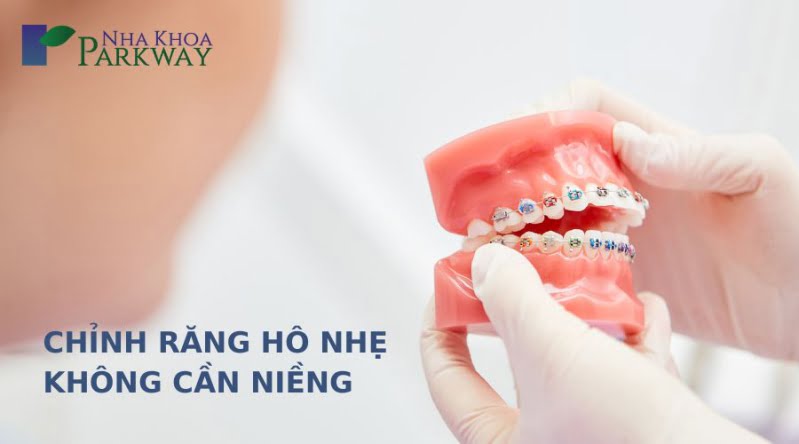 Sơ qua về cách chữa răng hô nhẹ không cần niềng