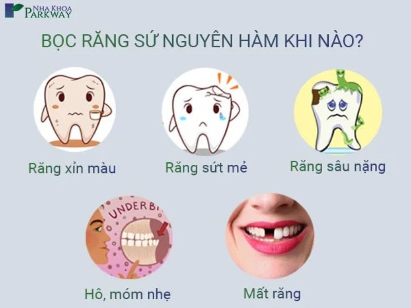 có nên bọc răng sứ cả hàm không