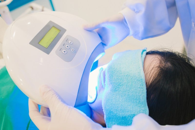 công nghệ tẩy trắng răng bằng laser có hại không