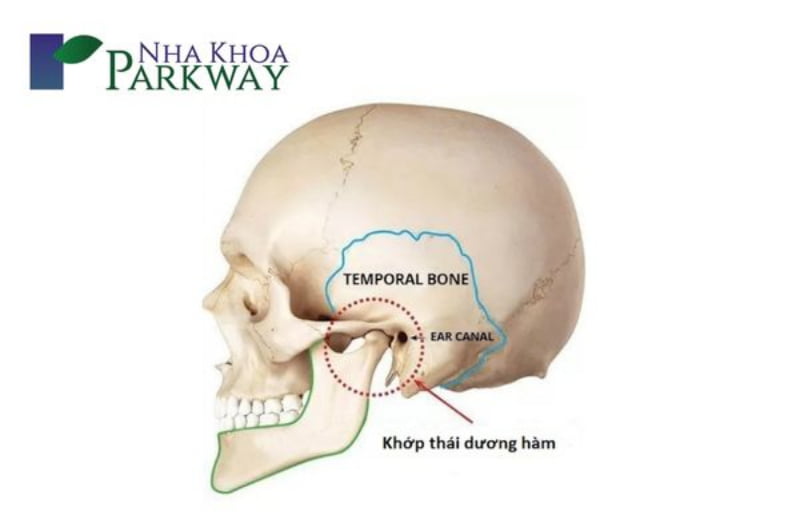 Những nguyên nhân dẫn đến đau răng hàm gây đau đầu