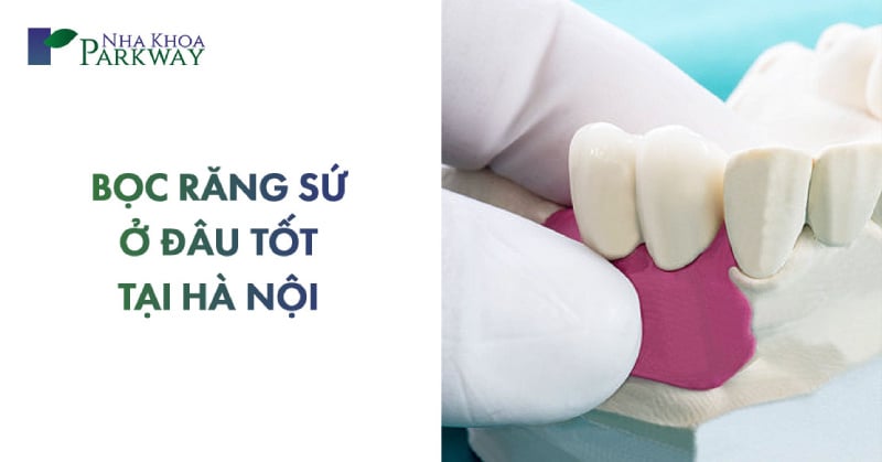 địa chỉ bọc răng sứ ở đâu tốt tại hà nội