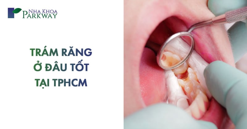 địa chỉ trám răng ở đâu tốt tại tphcm