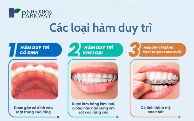 Các giai đoạn trong niềng răng 