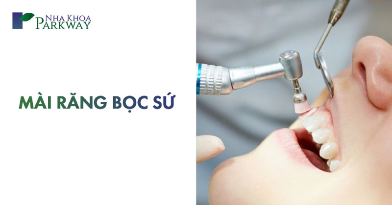 mài răng bọc sứ có ảnh hưởng gì không