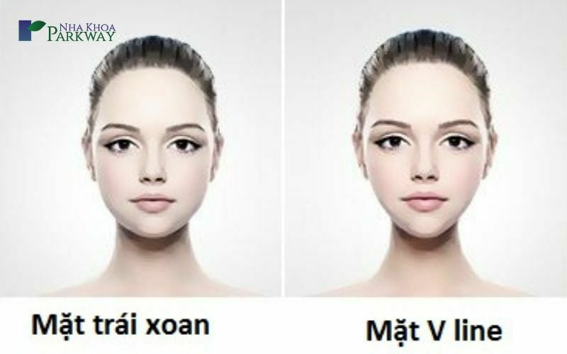 Mặt V-line và mặt trái xoan