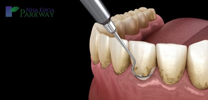 Nằm mơ thấy răng giả là điềm gì?