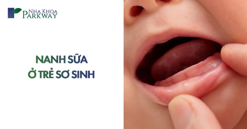 nanh sữa ở trẻ sơ sinh