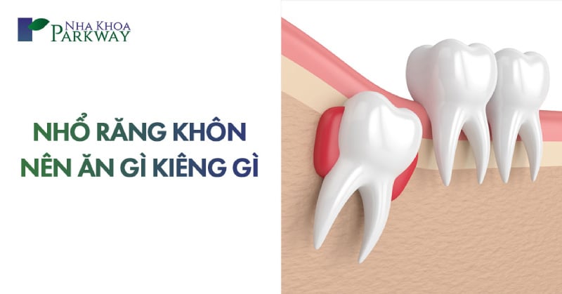 sau khi nhổ răng khôn nên ăn gì kiêng gì