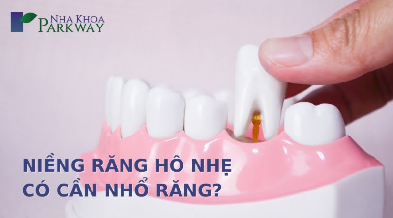 Niềng răng hô nhẹ có cần phải nhổ răng hay không?