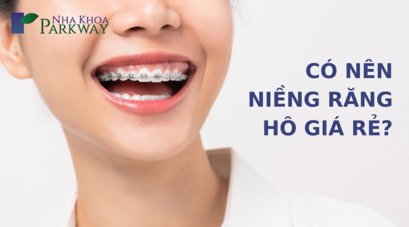 Có nên niềng răng hô giá rẻ hay không?