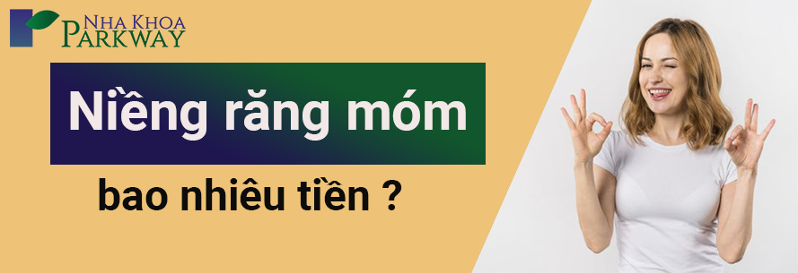 giá niềng răng móm bao nhiêu tiền