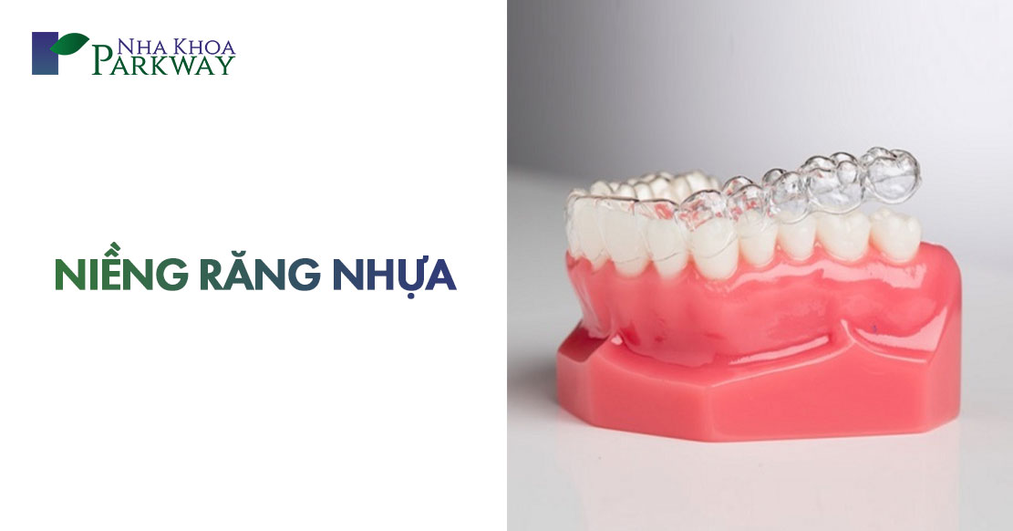 niềng răng nhựa