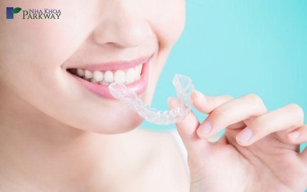 mắc cài trong suốt invisalign