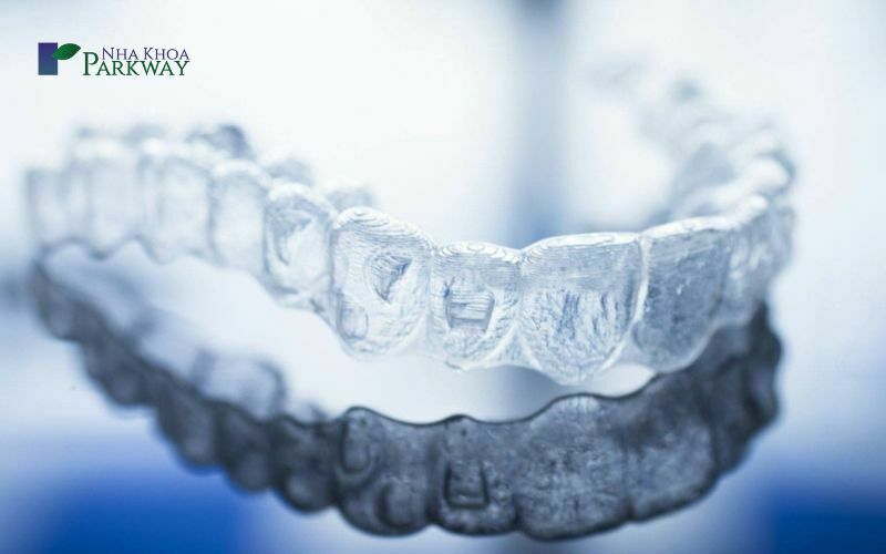 Niềng răng trong suốt Invisalign