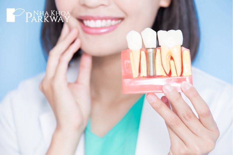 Trồng răng Implant để không bị nuốt răng giả vào bụng