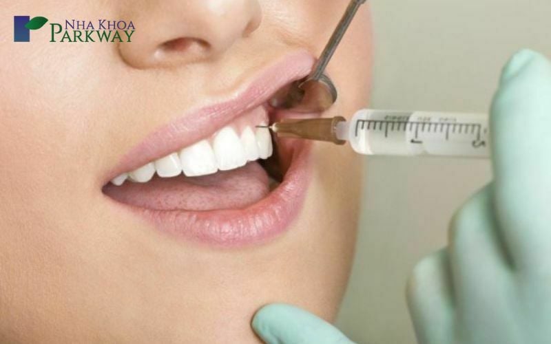 Tiêm botox - Điều trị cười hở lợi