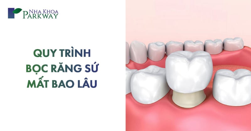 quy trình bọc răng sứ đúng cách như thế nào