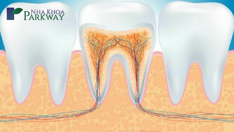 Điều trị tủy răng là gì?