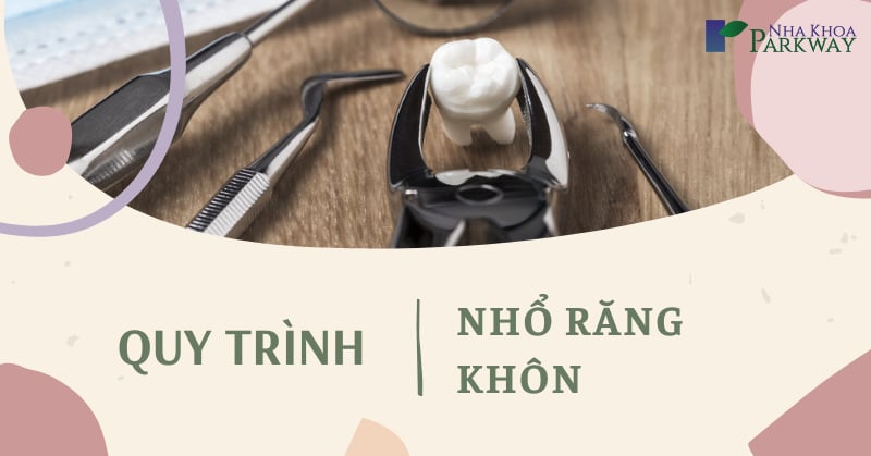 quy trình nhổ răng khôn như thế nào