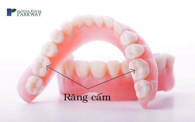 Nguyên nhân răng cấm bị sâu