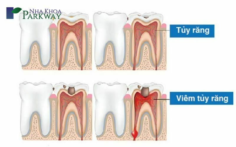 Gây ra những bệnh lý về răng miệng