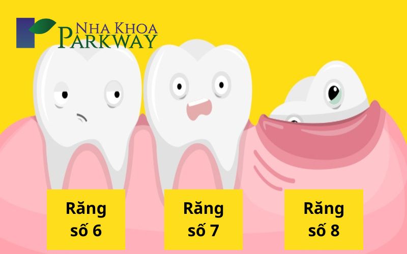 Phân biệt răng cấm và răng khôn