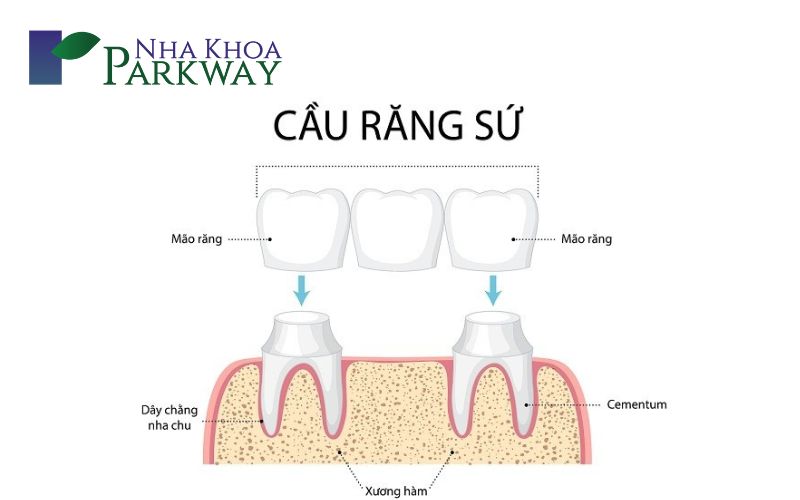 Một vài cách trồng răng nanh hiệu quả