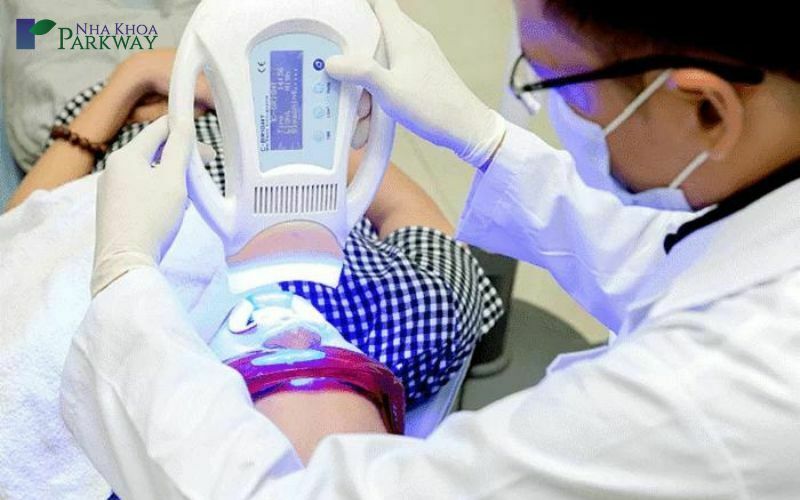 Phương pháp tẩy trắng từ ánh sáng laser