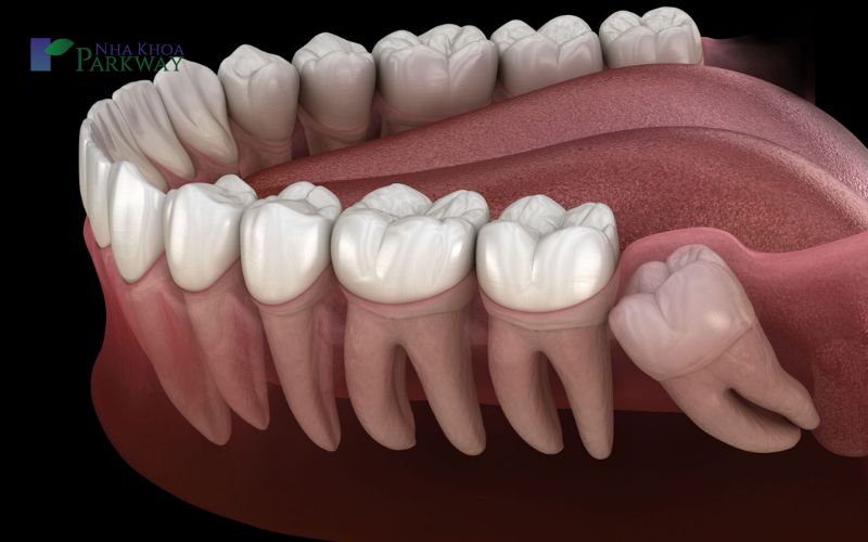 Răng số 7 mọc ở đâu?