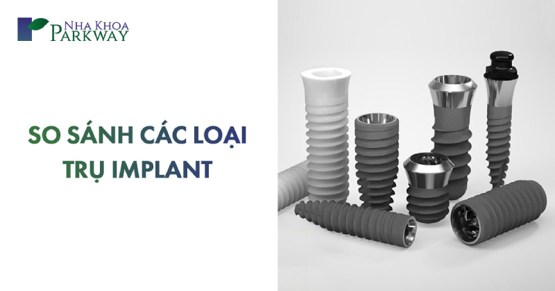 so sánh các trụ implant nào tốt nhất