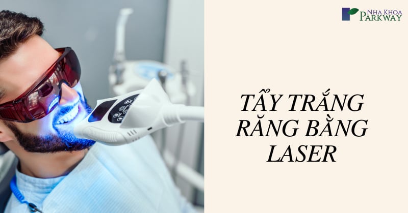 tẩy trắng răng bằng laser giá bao nhiêu tiền