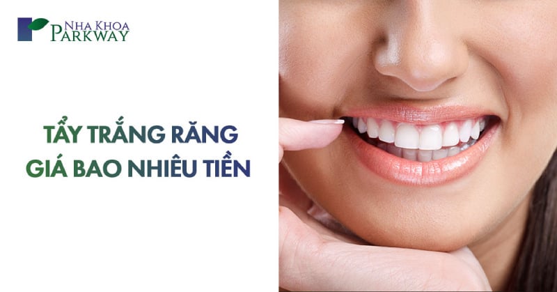 tẩy trắng răng giá bao nhiêu tiền