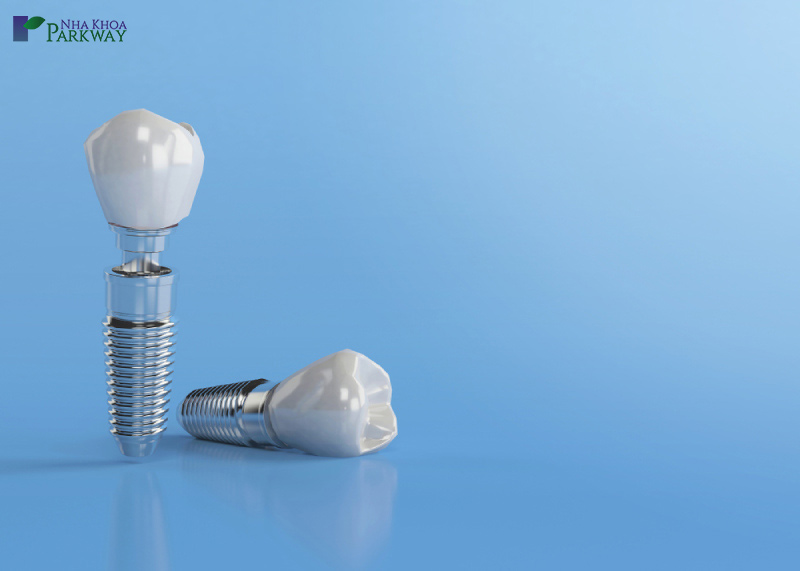 thời gian cấy ghép implant mất bao lâu