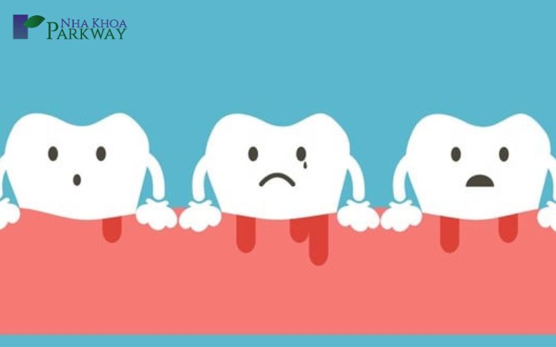 Trồng răng giả giá rẻ có nguy hiểm khôn