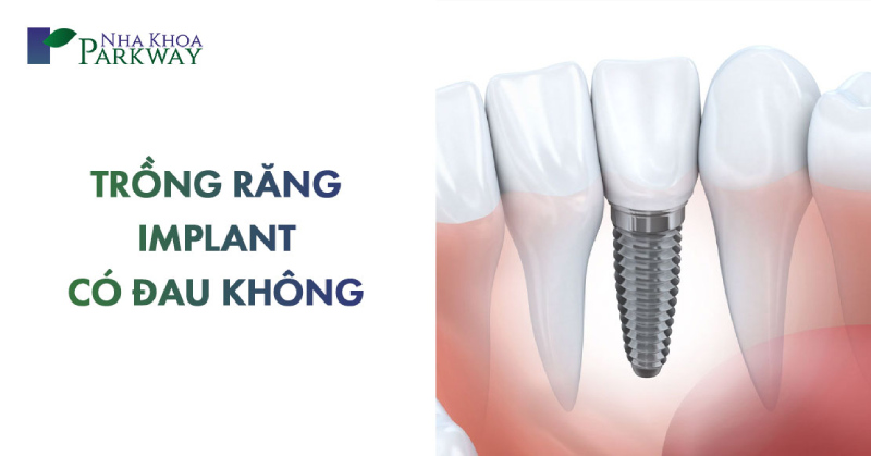 trồng răng implant có đau không